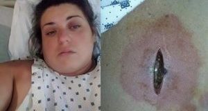 Млада жена: През нощта ме ухапа нещо като комар а на сутринта бях на крачка от смъртта (СНИМКИ)