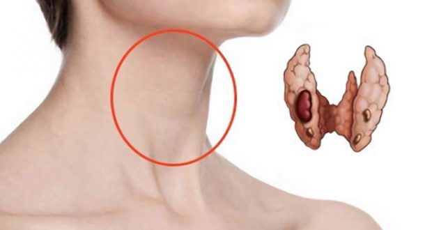 9 храни с високо съдържание на йод