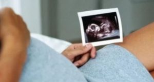 Жена роди без секс от 18 месеца и без да разбере че е бременна