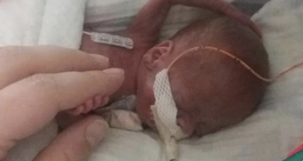 С нулев шанс за живот: Най-преждевременно роденото бебе в света отпразнува първи рожден ден (СНИМКИ)