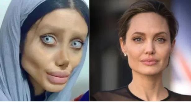 „Мъртвата булка“: Тя пръсна камара пари и си направи над 50 операции за да прилича на Анделина Джоли (СНИМКИ)