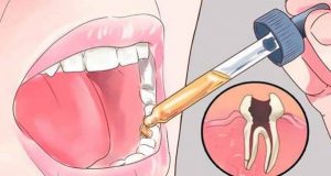 Ето как се премахва зъбобола за броени минути с подръчни средства-12 изпитани метода