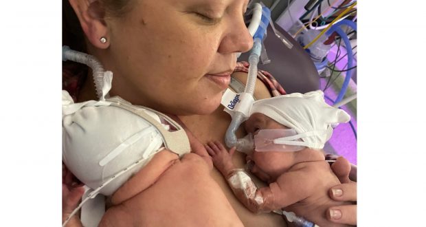 Близнаци се родиха в 22 седмица и лекарите им дадоха нулев шанс за оцеляване